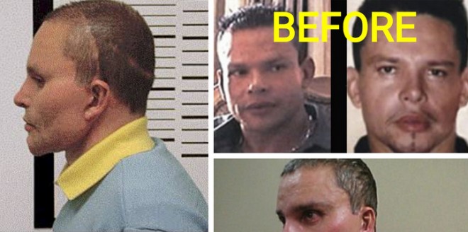 Cum a ajuns sa arate omul care a facut 4 operatii estetice ca sa nu fie gasit si ucis de El Chapo