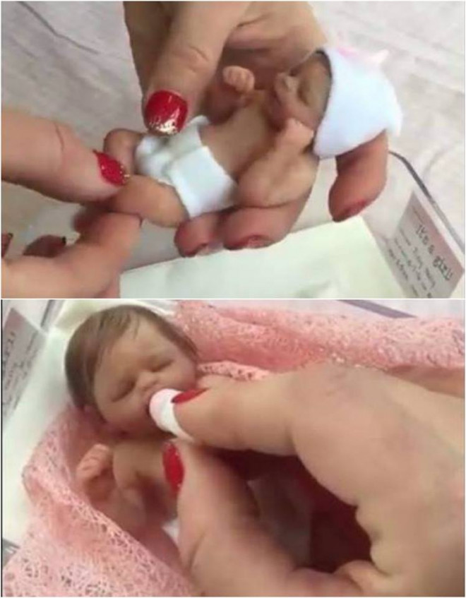 Cel mai mic bebelus din lume iti topeste inima