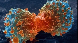 Descoperire românească împotriva cancerului. Ce plantă stopează multiplicarea celulelor canceroase 