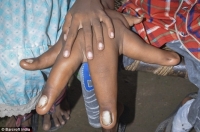 Un băiat din India ŞOCHEAZĂ LUMEA! Cum arată mâinile lui
